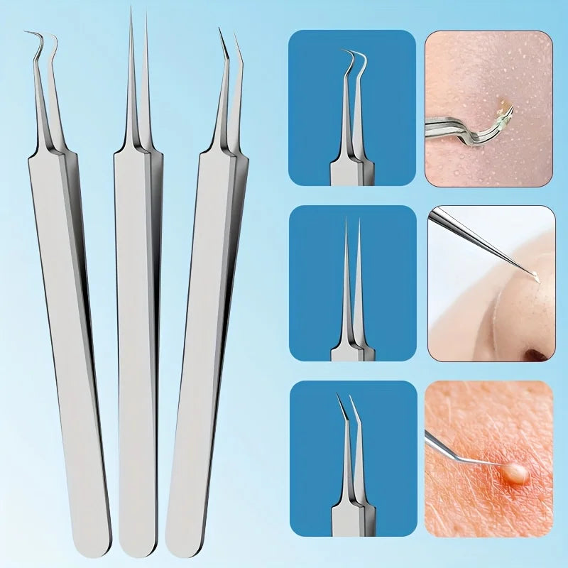 15pcs Facial Cleansing Beauty Tool Set Stainless Steel Pliers Cell Clips,Comedone Extractor,Blackhead and Whitehead Removal Tool