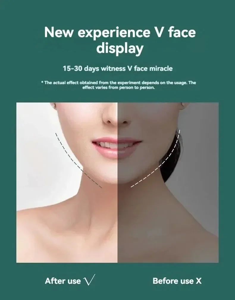 J...Slimming Face Belt Lifting Double Chin Face Mask Tight But Not Strangling Suitable For All Kinds Of Face Shape Slimming Tool